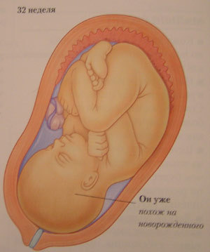 Плод. Тридцать две недели беременности